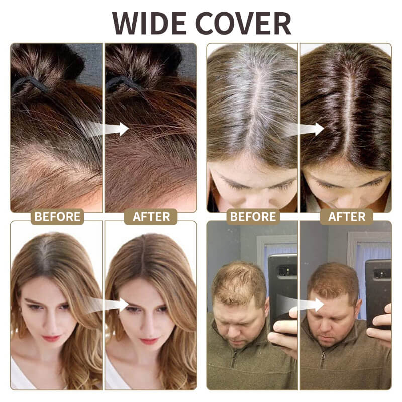 đź’‹Buy 1 Get 1 Freeđź’‹Upgrade Magic Root Cover Up 5