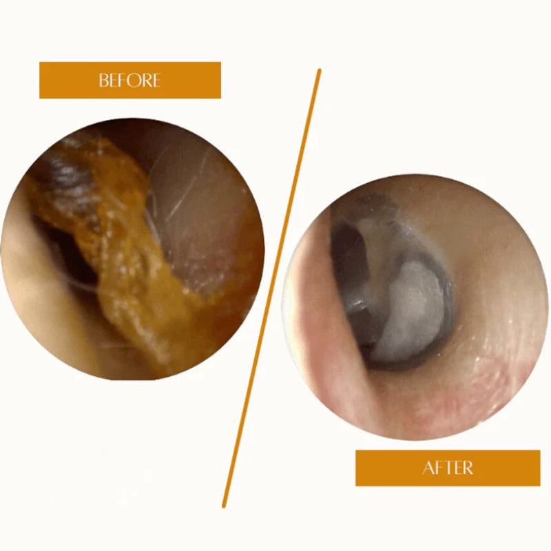 š„Hot Saleš„Painless Ear Cleaning for the Whole Family