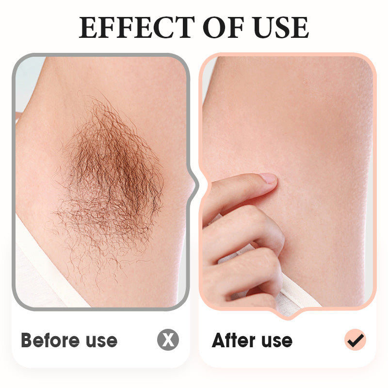 🎁LAST DAY 50% OFF🔥Gentle Hair Removal Cream for Underarms, Legs, and Arms